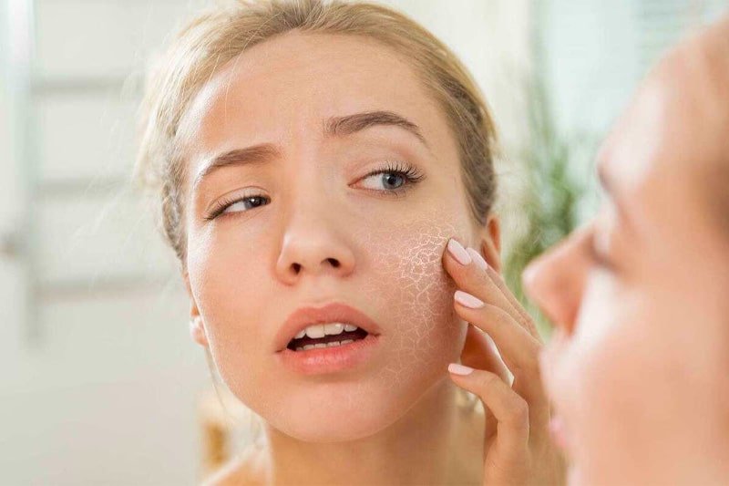 تأثیر سیگار بر پوست - آوا اودیولوژی